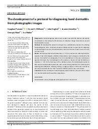 The development of a protocol for diagnosing hand dermatitis from photographic images. = (Elaboration d'un protocole pour le diagnostic de la dermatite au niveau de la main à partir d'images photographiques).. 5. 79 | PARSONS V.